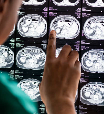 doctor-reading-brain-mri-x-ray-result 1